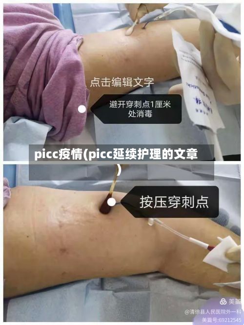 picc疫情(picc延续护理的文章)