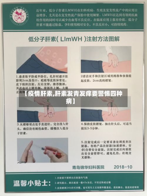 【疫情肝素,肝素发青发痒要警惕四种病】-第2张图片