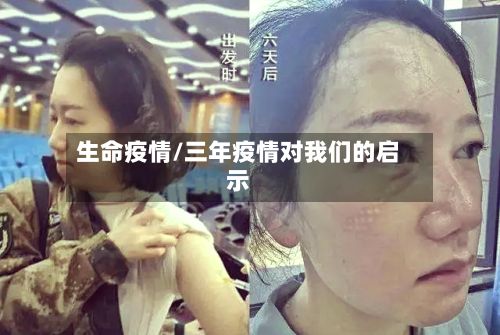 生命疫情/三年疫情对我们的启示-第2张图片