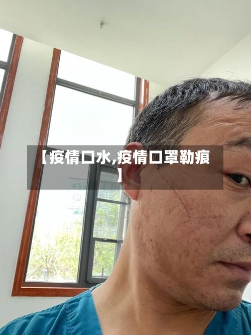 【疫情口水,疫情口罩勒痕】