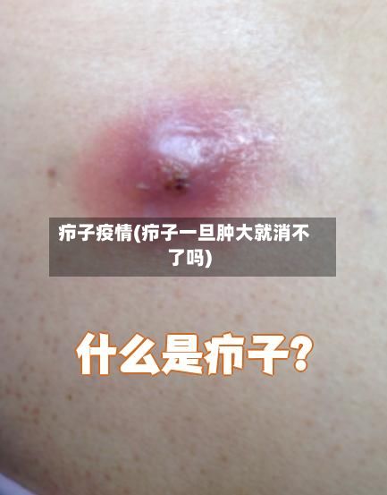疖子疫情(疖子一旦肿大就消不了吗)-第2张图片