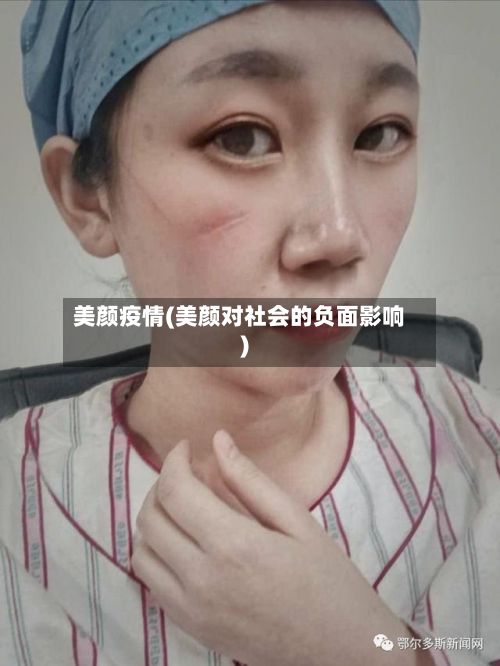 美颜疫情(美颜对社会的负面影响)-第2张图片