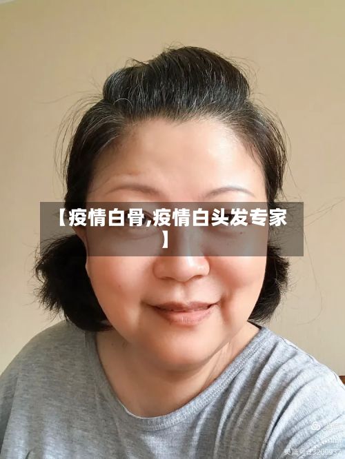 【疫情白骨,疫情白头发专家】-第3张图片